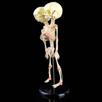 

Human Double Head Baby Skull Research Model Skeleton Anatomical Brain Anatomy