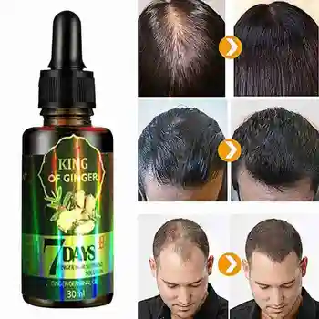 

Ginger Essential Oil Hair Growth Essence Hair Loss Hair Essence Liquid Fast Growth Dense Sunburst 30ml Grow Hair G0B6