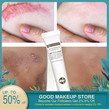 

VIBRANT GLAMOUR Repair Scar Cream Removal Scars for Face or Body Pigmentation Corrector Scalded Surgery Scar Insect Skin Care