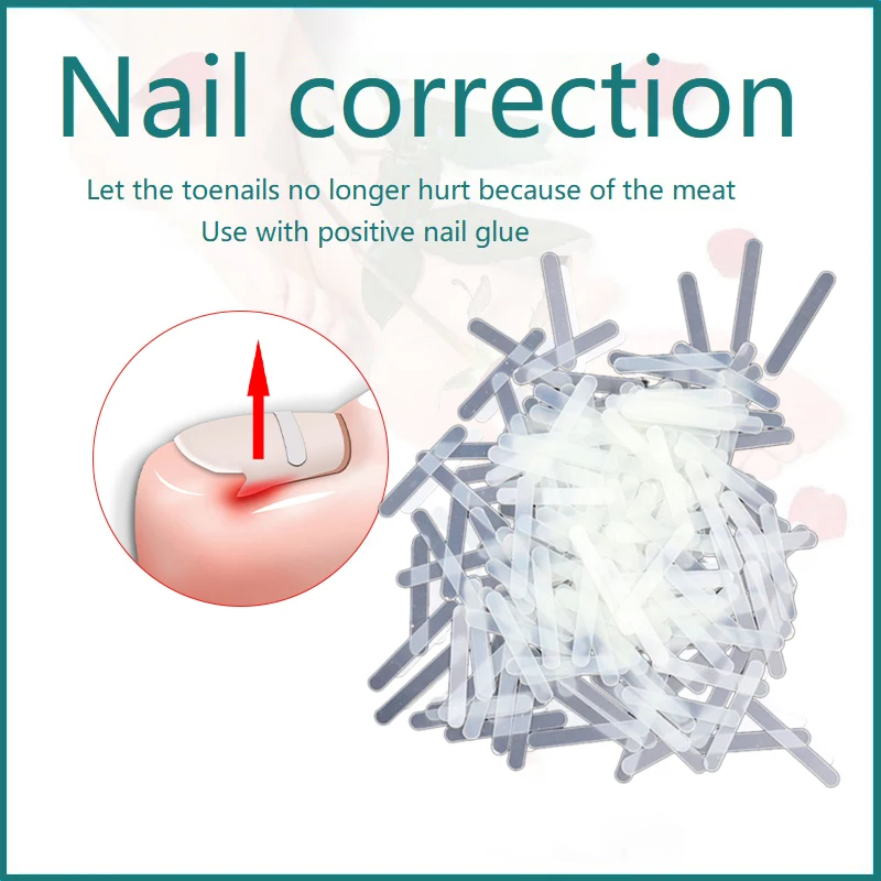 Ingrown Toenail Correction Tool 10pcs Ingrown Toe Nail Treatment Elastic Patch Sticker Straightening Clip Brace Pedicure Tool