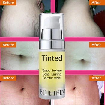 

Stretch Marks Repair Cream Removal Scar Marks Cream Fat Scar Striae Treatment Anti-Aging Firming Creams TSLM1
