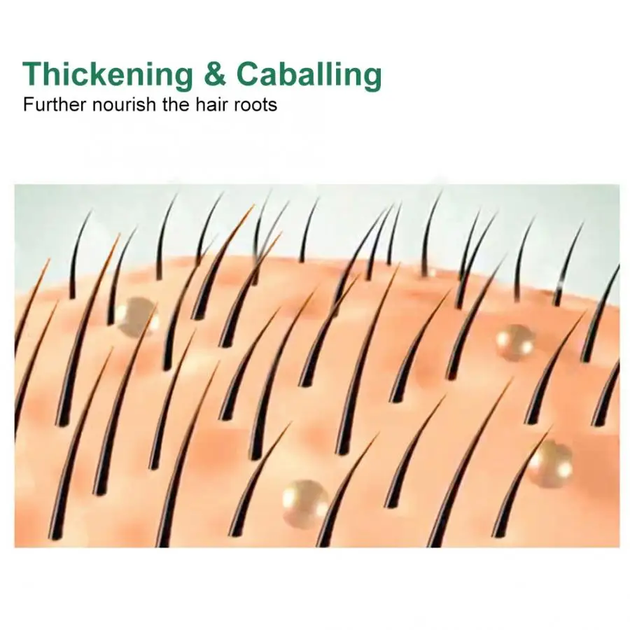 Эссенция для ухода за волосами, эссенция для роста волос, имбирь, натуральный растительный экстракт, против выпадения волос, жидкое средство для ухода за волосами