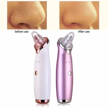

USB Rechargeable Vacuum Blackhead Remover Facial Vacuum Pore Cleaner Nose Acne Facial Skin Care Tool Beauty Suction Device