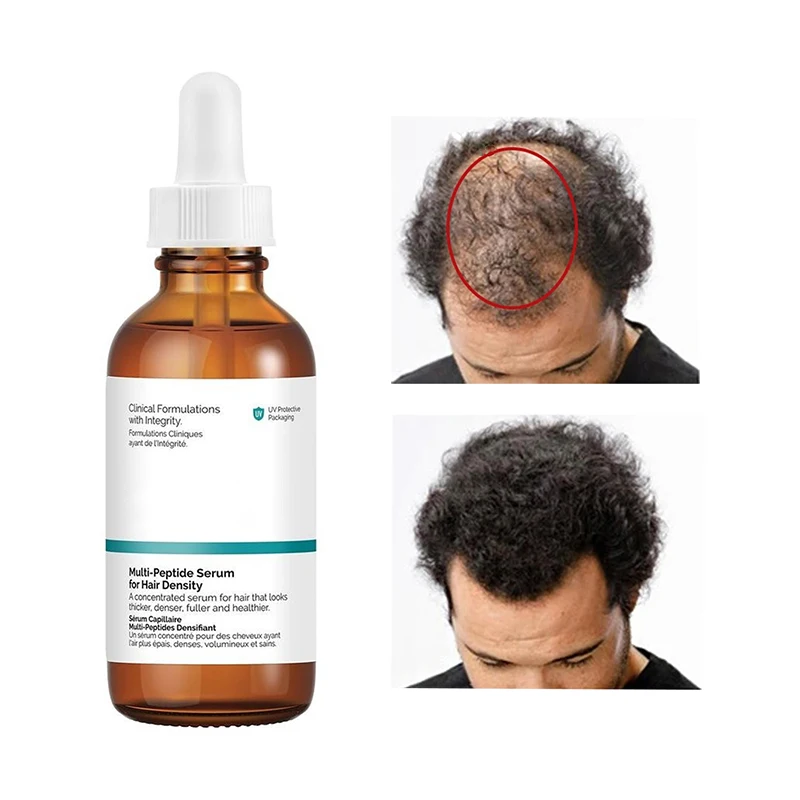 Multipeptide Serum For Hair Density 60ml， Ordinary Hair Fast