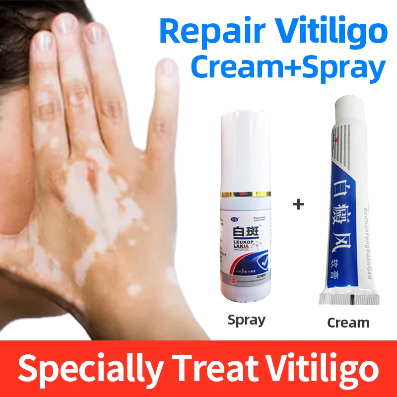 Китайский медицинский Антибактериальный крем Vitiligo способствующий развитию кожи