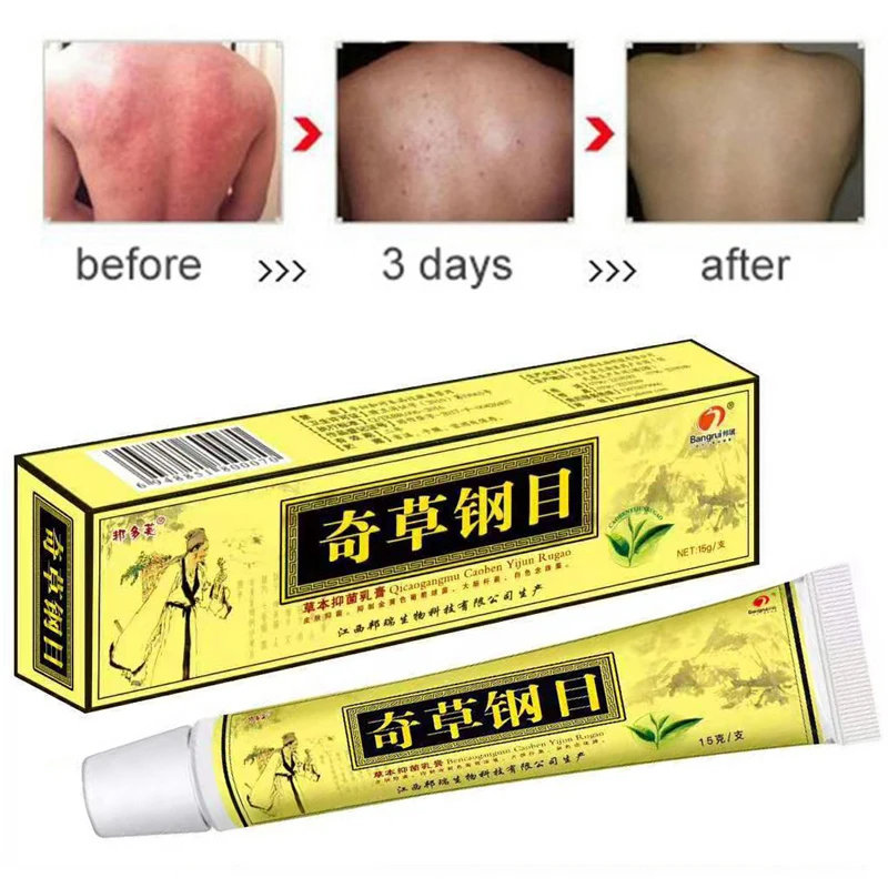 Dropshipping 20PCS QICAOGANGMU Focallure Skin Psoriasis Cream Dermatitis Eczematoid Ointment Treatment |