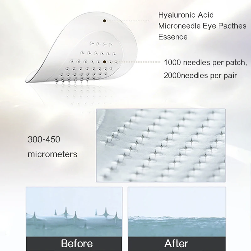 Eye Patches Hyaluronic Acids Microneedle Eye Pads Moisturizing Wrinkles Fine Lines Dark Circles Removal Collagen Eye Mask Patch