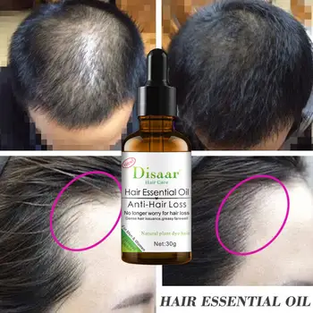 

Fast Hair Growth Essence Essential Oil Treatment Preventing Hair Loss Hair Care