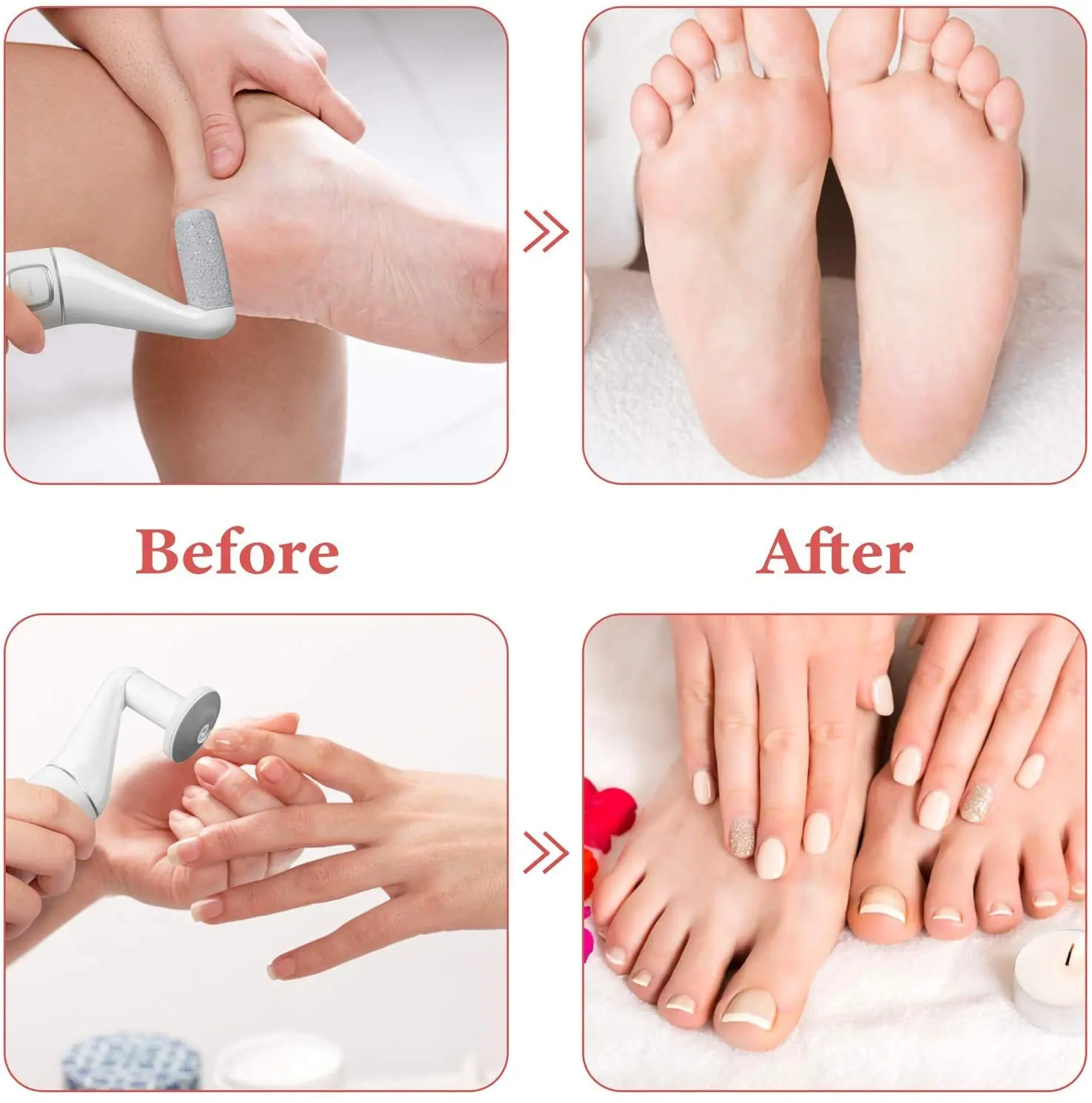 Electric Foot File Callus Remover Machine Pedicure Device Foot Care Tools Feet For Heels Remove Dead SkinFoot repair tool 6