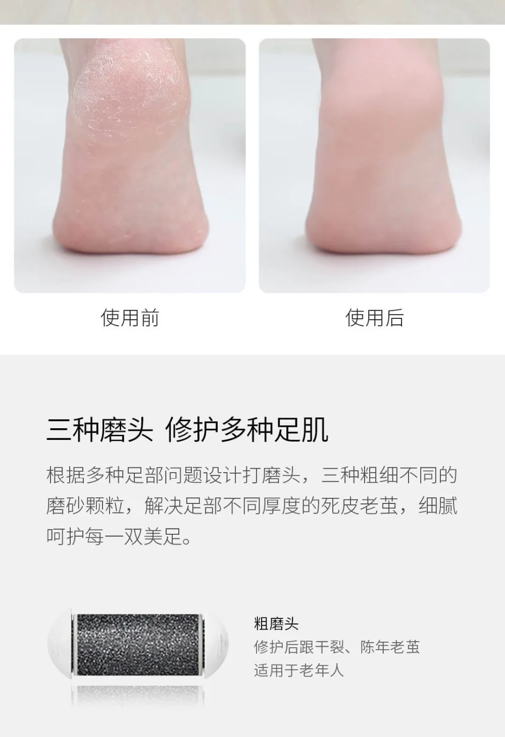 Doco Electric Pedicure Foot Care Grinding Skin Hard Rupture Remover Foot File Grinder Dead Skin Callus Remove Pedicure Tools (16)