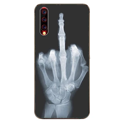 Чехол для телефона с рисунком для UMIDIGI X, чехол из мягкой силиконовой резины, чехол для задней панели s для Umidigi X, защитный чехол 6,35 дюйма - Цвет: W86