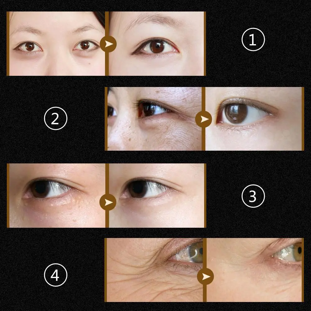 60PCS Black Pearl Watering Lady Eye Mask Moisturizing Hydrating Firming Rejuvenating Eye Mask Repair Brightening Eye Mask 60PCS Black Pearl Watering Lady Eye Mask Moisturizing Hydrating Firming Rejuvenating Eye Mask Repair Brightening Eye Mask