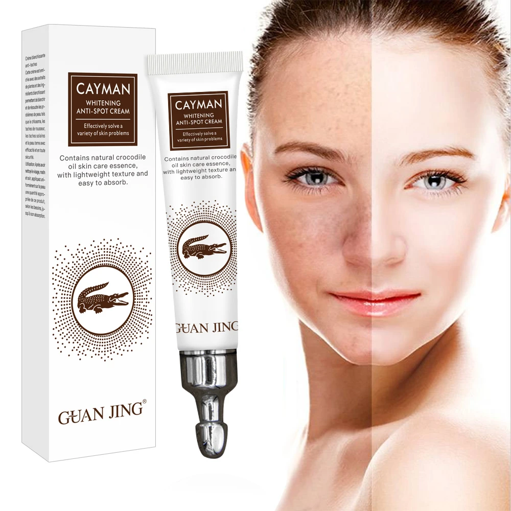 sun spots on face cream