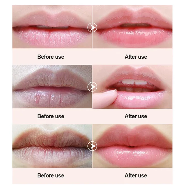 Lip Mask 20PCS Box Repair Dry Care Lips Soften Keratin Long Lasting Lighten Lip Lines Gloss