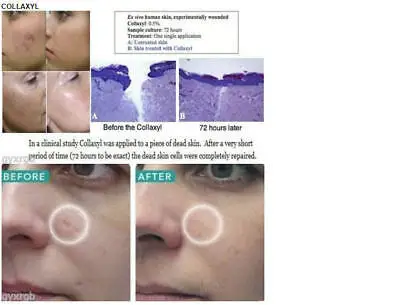 

10ml collagen peptide fade acne scars /boost collagen /line filler