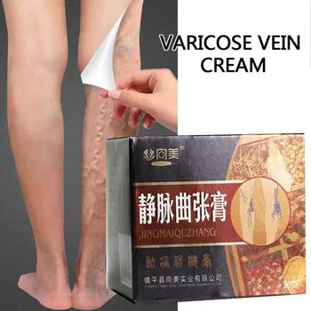 

Varicose Veins Treatment Cream Effective Varicose Vein Pain Relief Ointment Varicosity Angiitis Treatment Ointment Herbal Cream