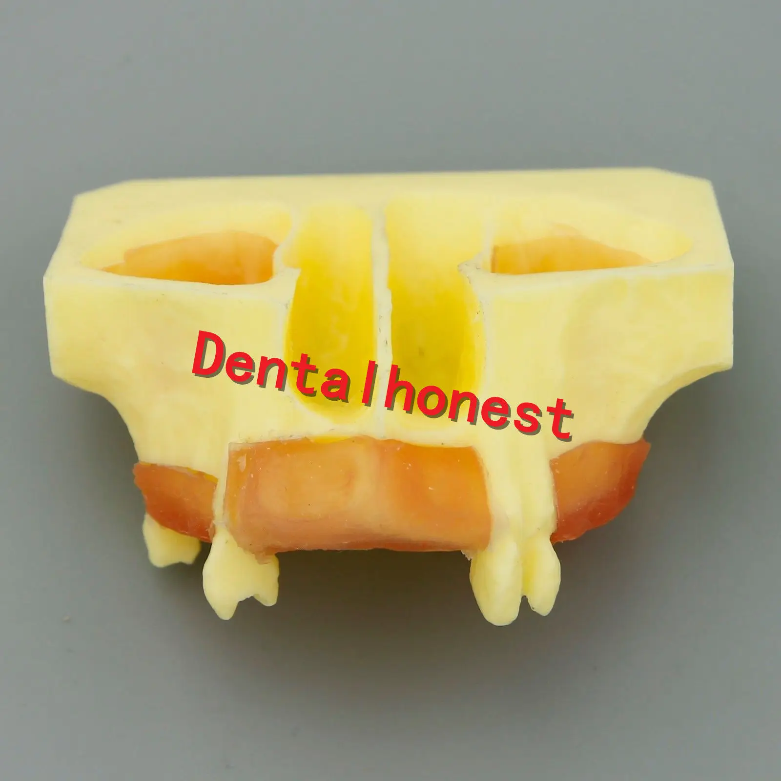  Dental Sinus Lift Practice Teeth Model Typodont Study Model 2013 01