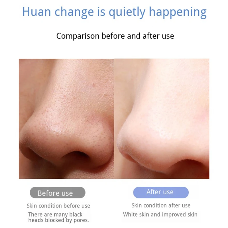  Electronic Facial Scrubber Ultrasonic LED Electronic Beauty Device Shovel Skin Pores Cleaning Face  - 4000469080563