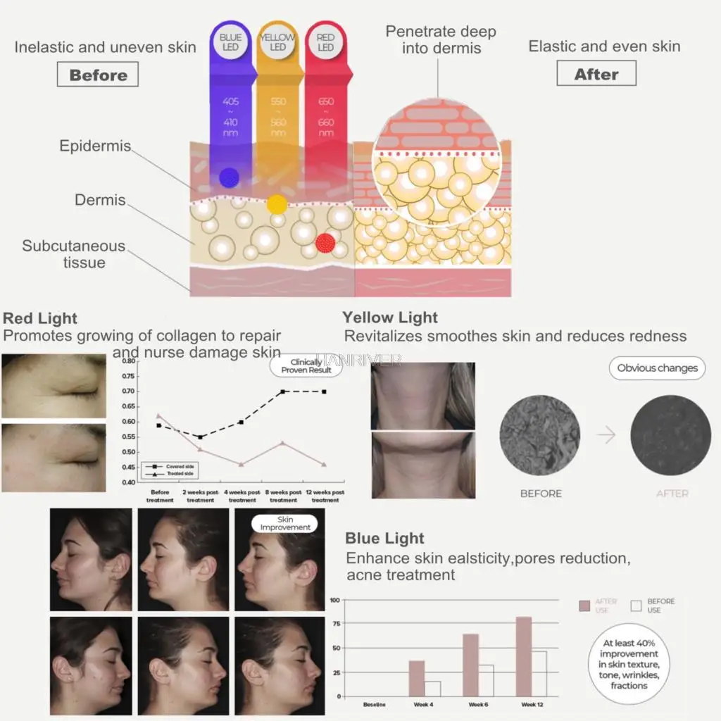 Led Masker Huidverjonging Gezichtsverzorging Gezicht Aanscherping Photon Lichttherapie Masker Anti-Aging Anti-Rimpel