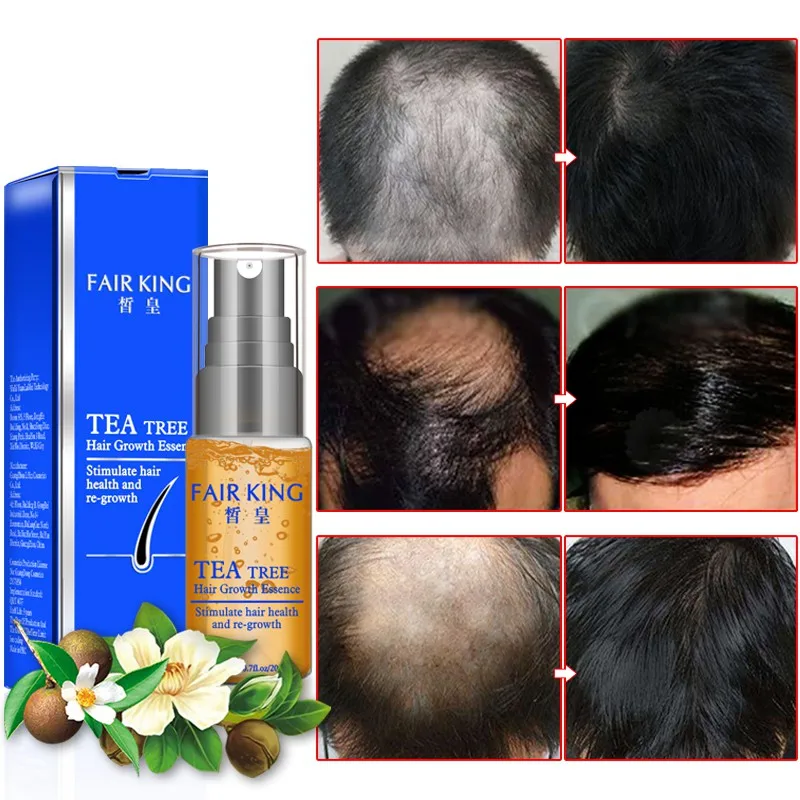Сывороточная эссенция для роста волос на 7 дней для мужчин и женщин против выпадения волос