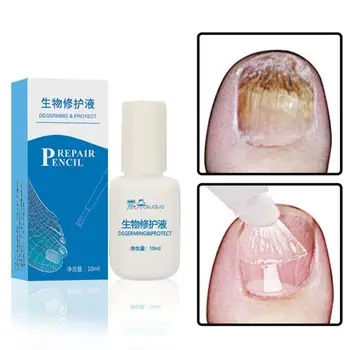

20g Nail Fungal Treatment Pen Antibacterial film Anti Fungus Infection Repair Solution Gel Fingernails Toenails Care