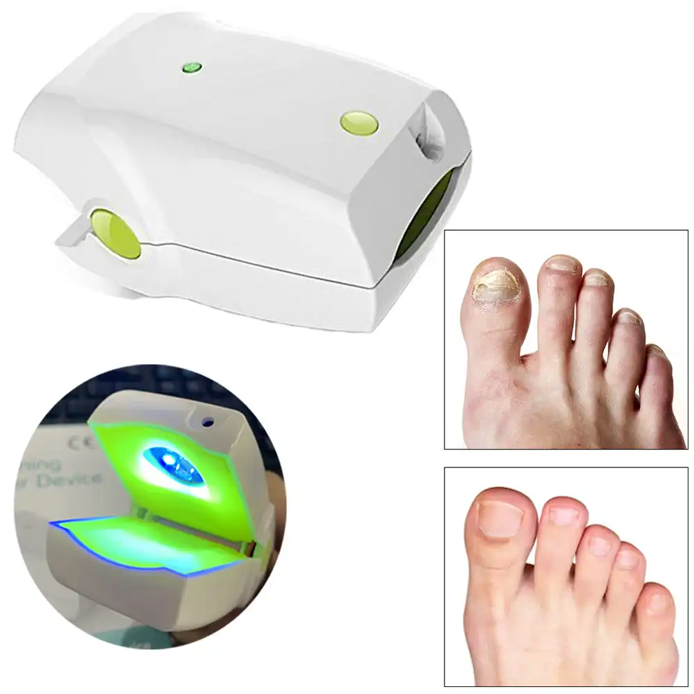 Rechargeable 905nm Laser Nail Fungus And 465nm Blue Light Therapy Device For Nail Fungal Infection Onychomycosis Treatment Relaxation Treatments Aliexpress