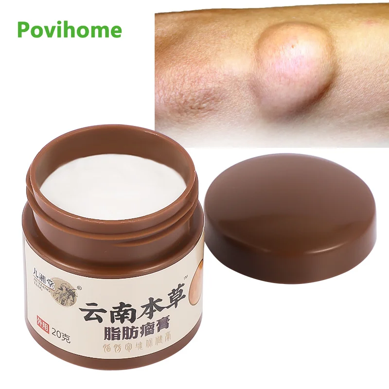 20g Herbal Lipoma Pain Relief Ointment Multiple Anti-Tumor Peeling Fat Mass Remove Cream Medicine Removal Plaster | Красота и