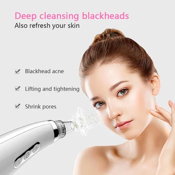 

Vacuum Blackhead Remover Electric Facial Comedo Suction Pore Cleaner Extractor Tool 5 Replaceable Suction Heads