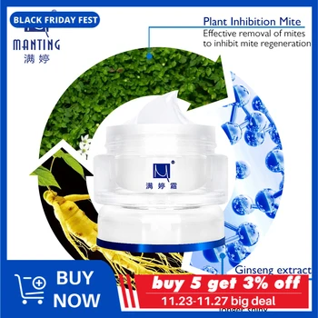 

Manting Body and face acne remove Cream Mite Bug Face Care Acne Treatment Scars and manting soap body Nutritious remove itch