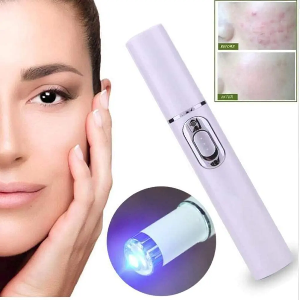 Blue Light Therapy Varicose Veins Treatment Laser Pen Soft Scar Wrinkle Removal Treatment Acne Laser Pen Massage Relax blue light therapy pen laser pen therapy