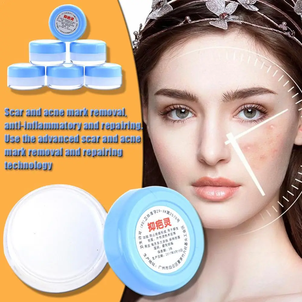 permanent acne removal cream