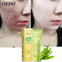 OEDO Aloe Remove Acne Scar Gel Seaweed Moisturizing Whitening Face Cream Shrink Pore Smooth Skin Moisturizing Essence Care 50g