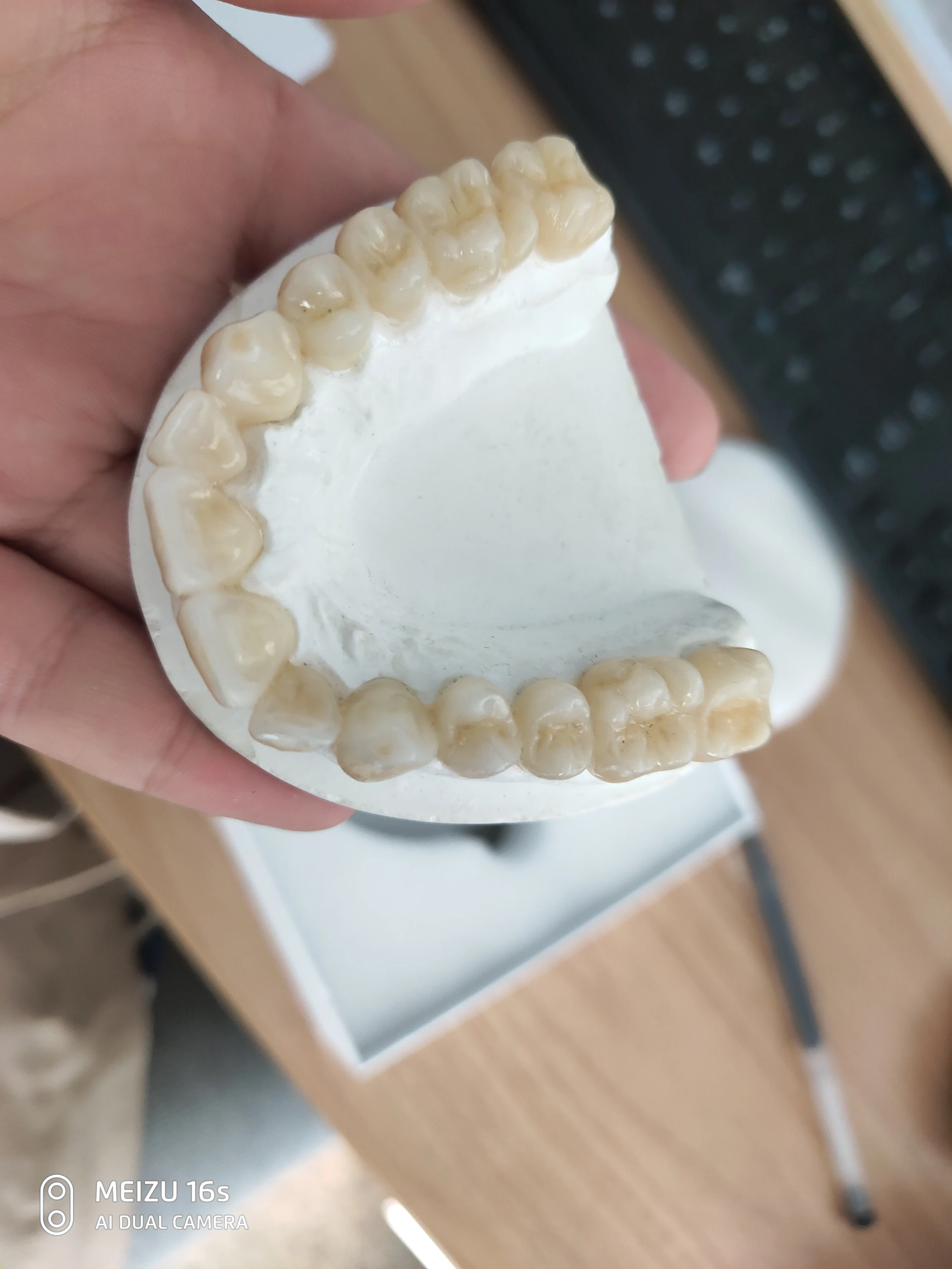 5 pieces sirona UT EX extreme aesthetics multlayer ultra translucency high strength zirconia blocks