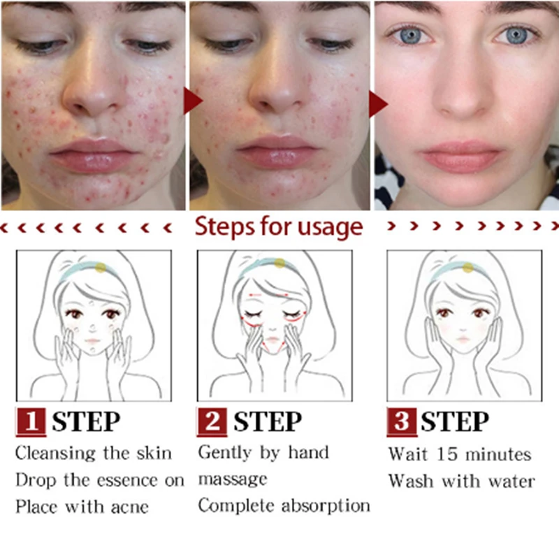 Центелла азиатской элиты эссенции sеrum visage Liquid hydratant анти-аттракцион ratizement huile de contróle des p