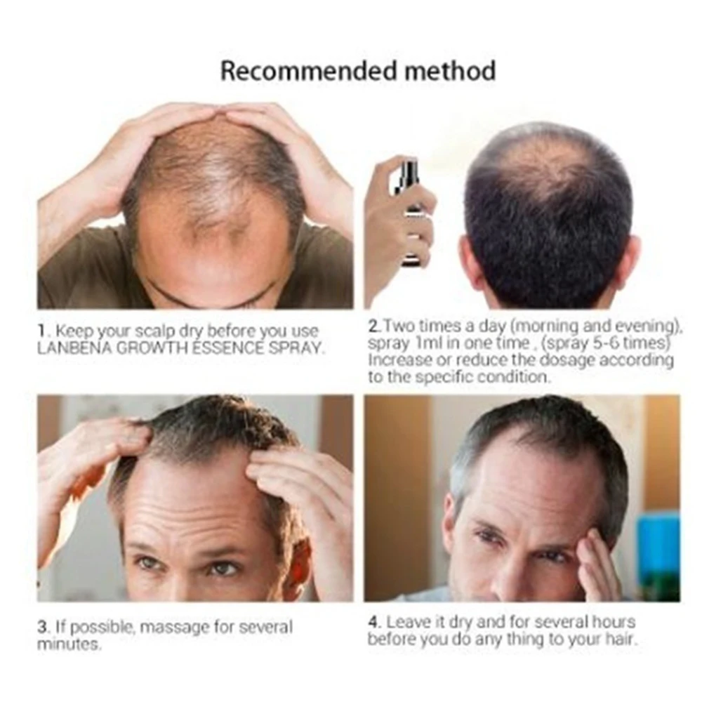 Baldness алопеция увеличивает питание Здоровое средство для роста волос мазь роста волос 30 мл жидкость роста волос эффективная Мода