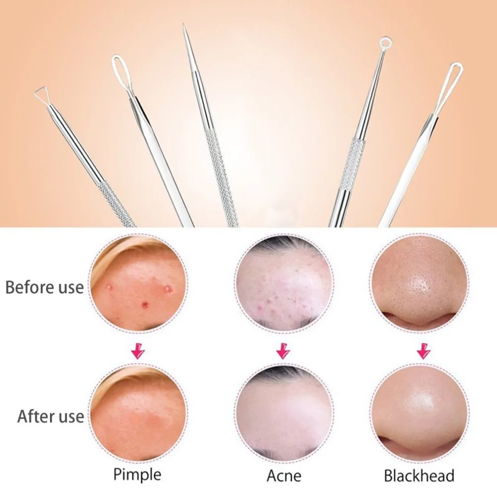 7Pcs Stainless Steel Blackhead Extractor Remover Tool Pimple Blemish Extractor Facial Skincare Set Kit With Leather 3