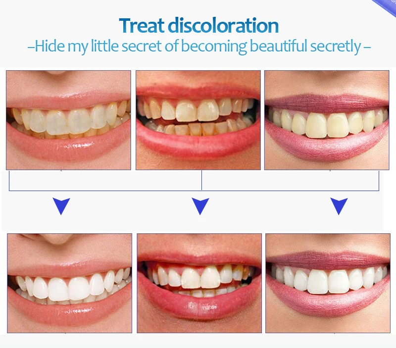 1 шт. карандаш для отбеливания зубов средство для отбеливания зубов товары для чистки полости рта отбеливающая Стоматологическая гелевая ручка удаление налета пятна уход за зубами