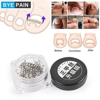 

12Pcs/Set BYEPAIN Ingrown Toe Nail Correction Wire Fixer Pedicure Paronychia Recover Toenails Corrector