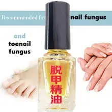 3 дня эффект удаления грибка жидкий грибковый Лечение ногтей яркий ремонт ногтей анти-инфекция Уход за ногами онихомикоз