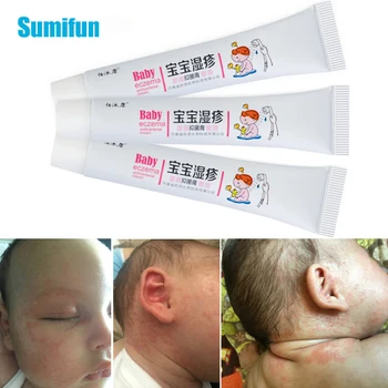

Sumifun Baby Eczema Ointment Antibacterial Herbs Pain Relief Treatment Psoriasis Pruritus Chinese Medical CreamP1122