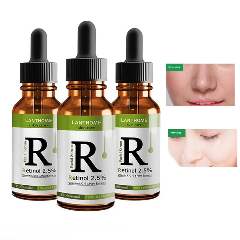 Retinol 2.5% Vitamin C / A Anti Wrinkle Serum Dark Whitening Remove Anti Serum Face Collagen Serum Aging Spots X5R9 Retinol 2.5% Vitamin C / A Anti Wrinkle Serum Dark Whitening Remove Anti Serum Face Collagen Serum Aging Spots X5R9