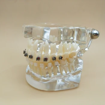 

2Times Orthodontic teeth model/Dental orthodontic restoration tooth model/Orthodontic aesthetic brackets