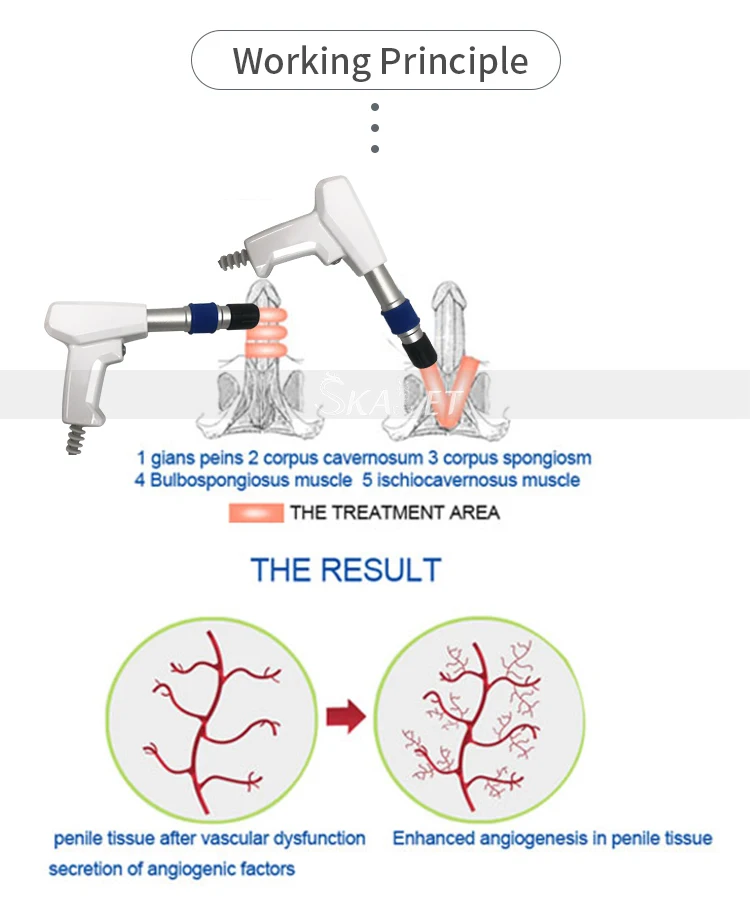 Высокое качество шоковая волновая Терапия ESWT устройство облегчение боли эрекционная дисфункция лечение машина