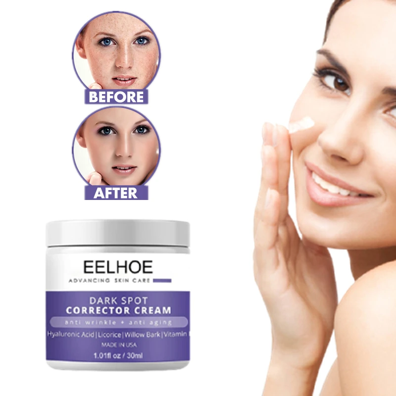 EELHOE Effective Whitening Cream Anti Wrinkle Freckle Moisturizer Melanin  Melasma Acne Dark Spot Corrector Skin Care Creams 30g| | - AliExpress