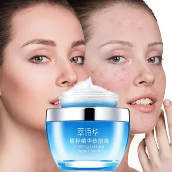 

Dark Spots Acne Treatment Blackhead Whitening Cream Repair Care Creams Face Pigment Acne Skin Cream Removal Scar Melanin A4S9