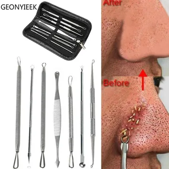 

Hot Sale 1 Set Stainless Steel Extractor Blackhead Remover Needles Acne Pimple Blemish Treatments Face Skin Care Beauty Tools