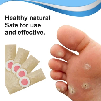 

Corn Removal Patch Toe Callus Corn Remover Pads Wart Treatment Patch For Foot