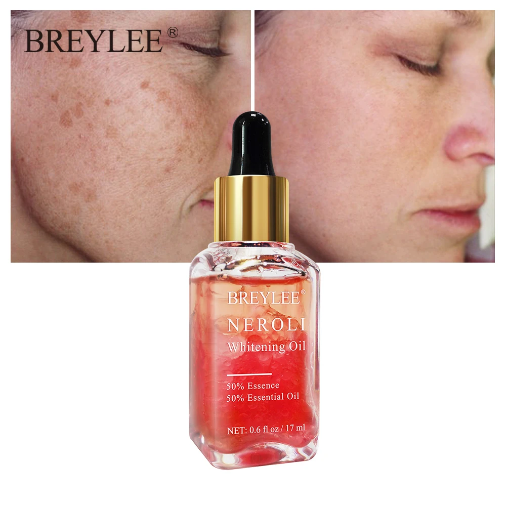 BREYLEE Neroli Whitening Essential Oils Fade Dark Spots Remove Face Freckle Brighten Skin Facial Serum Moisturizer Essence Oil  (3)