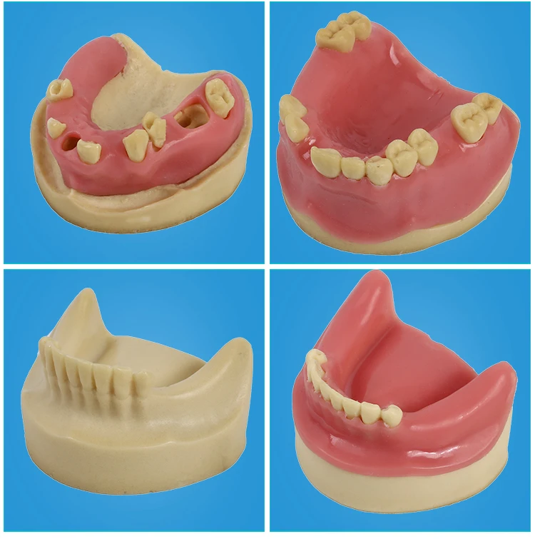 Стоматологические материалы модель орального имплантата хирургические maxillary sinus Стоматологические принадлежности оборудование инструменты мягкие десны