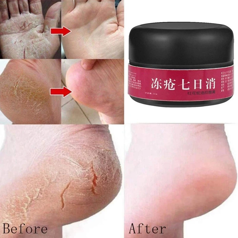 Мазь крем для рук Крем для ног крем от трещин пятки ремонт Frostbite анти сухой трещины кремы для кожи